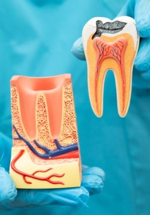 Dental Implants in Calamba