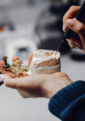 Dental Implants in Calamba